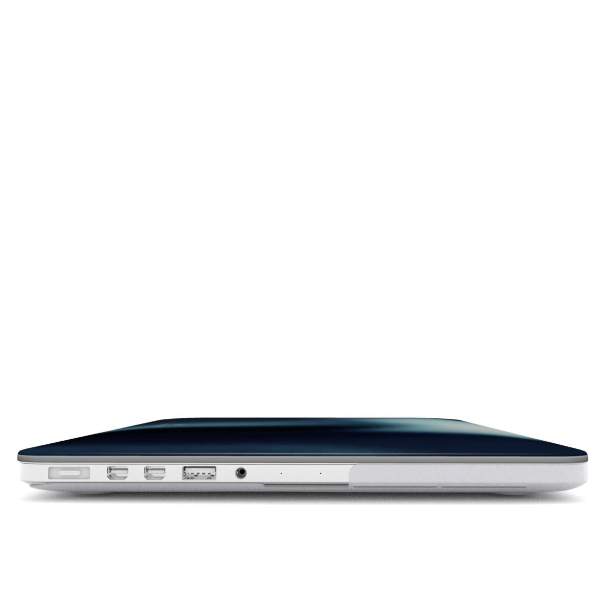 MACBOOK CASE (MYRALITH)