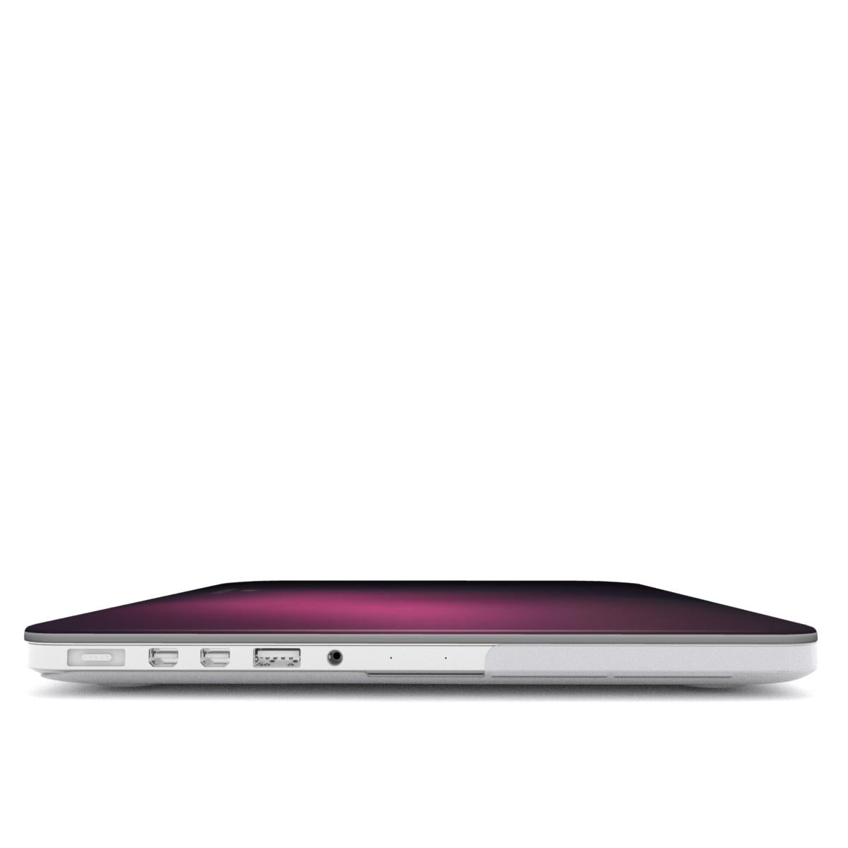 MACBOOK CASE (NOIRROSA)