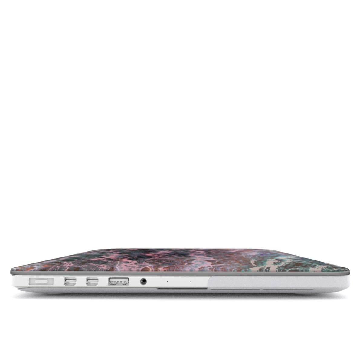 MACBOOK CASE (ROSYRA)
