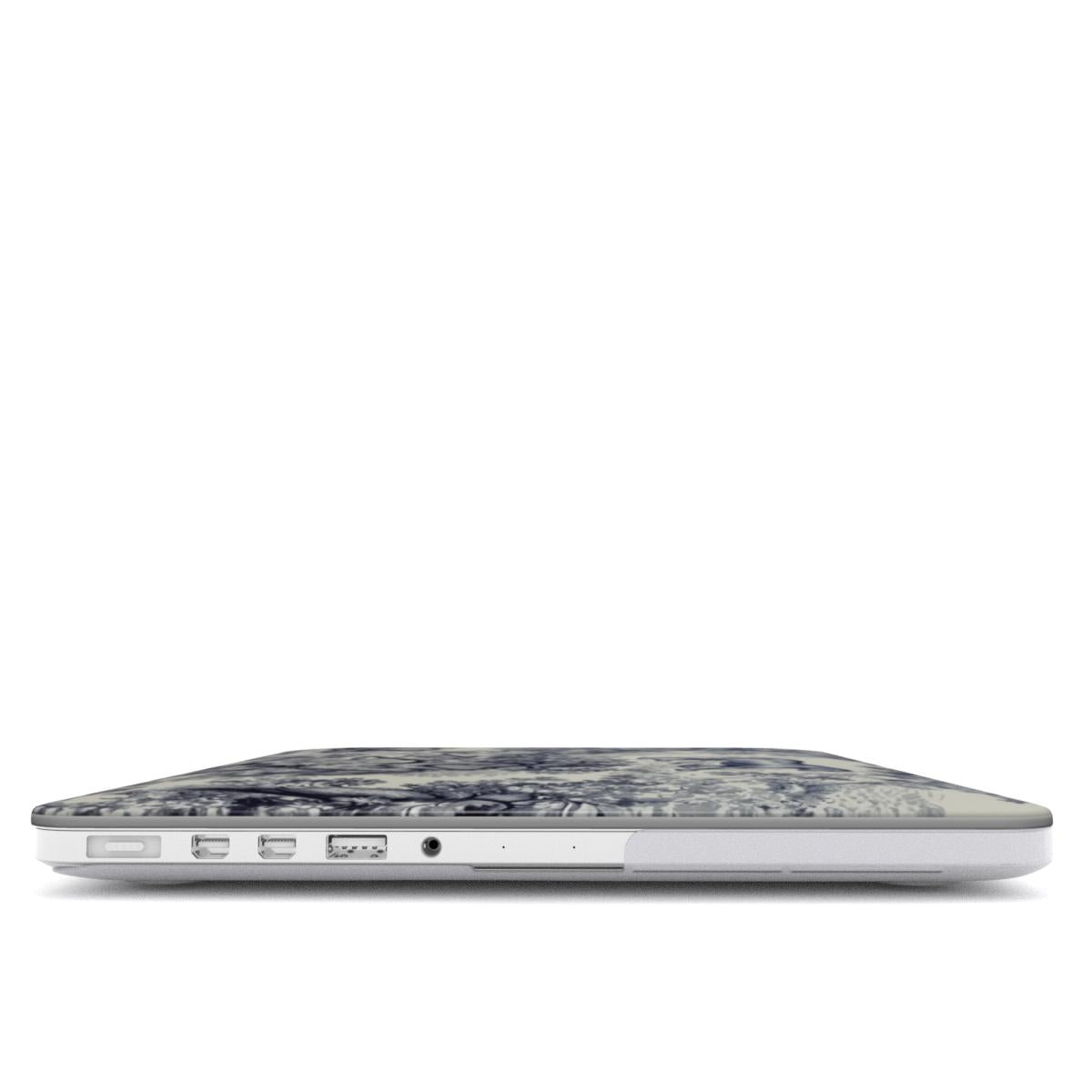 MACBOOK CASE (CELAVON)