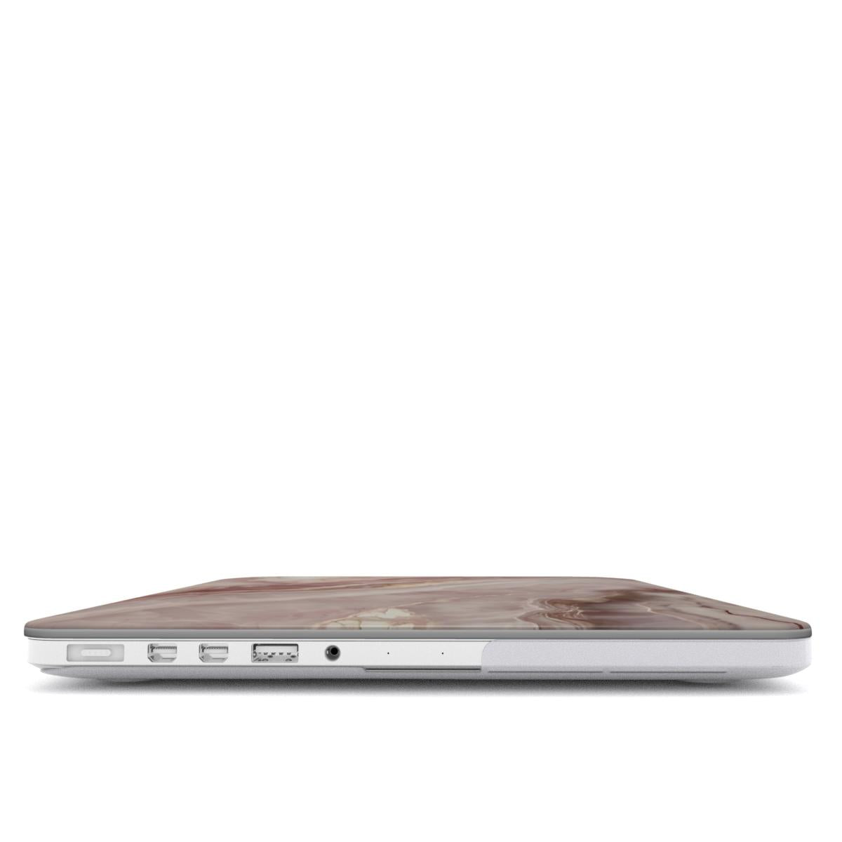 MACBOOK CASE (NIRA)